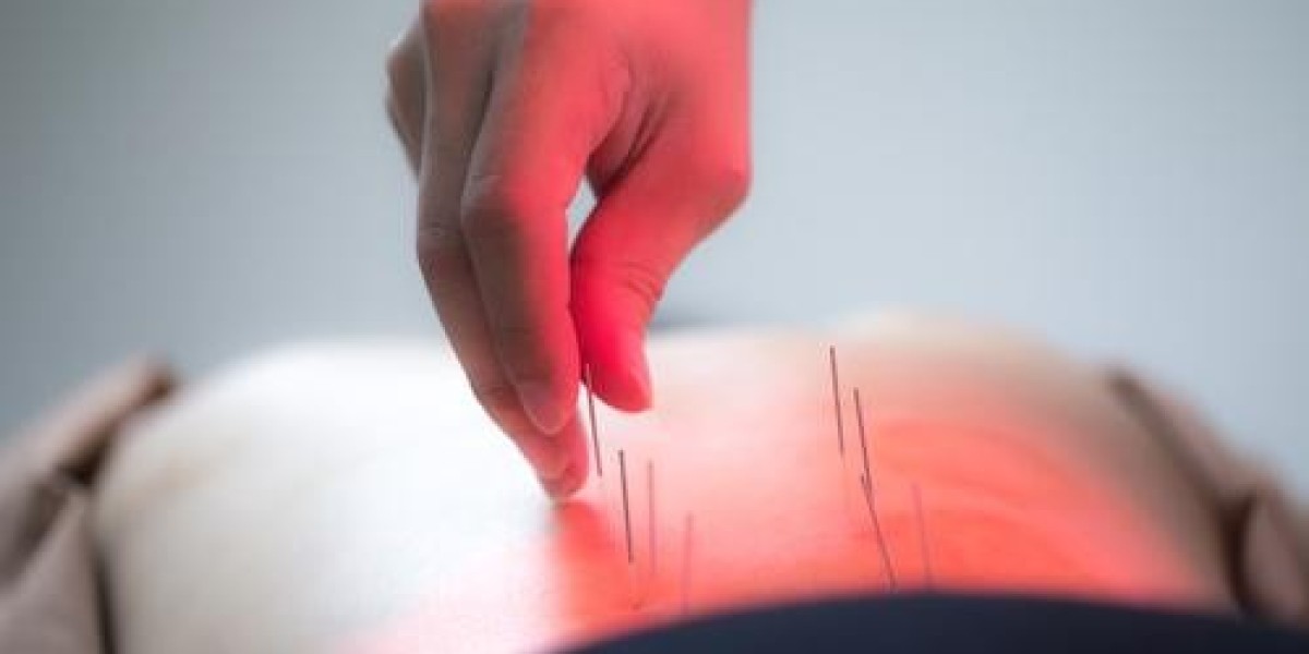 Experience Relief with Acupuncture For Neck Pain In Morristown – CM Harmony