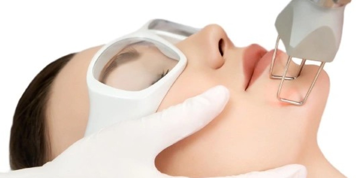 Fractional CO2 Laser Pricing in Dubai: Factors That Influence Your Treatment Costs