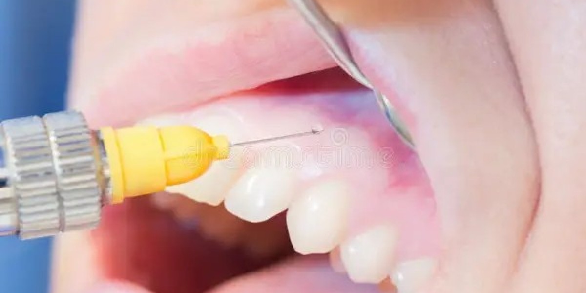 Dental Anesthetics Market: Future Outlook and Growth Prospects