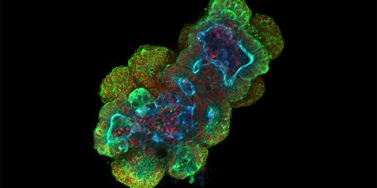 Organoids Market: Pioneering the Future of Personalized Medicine and Disease Modeling