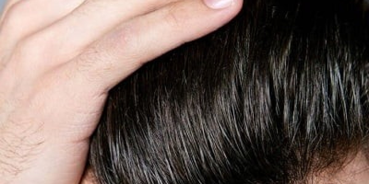 Does transplant hair grow?