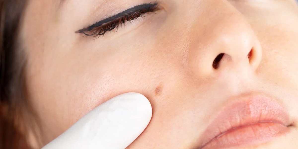 Advanced Technology for Wart-Free Skin: Achieving Smooth and Clear Skin with the Latest Innovations