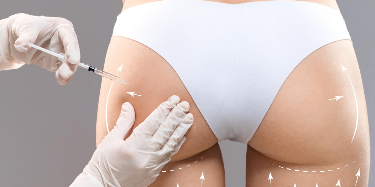 Butt Fillers in Riyadh: A Step-by-Step Guide