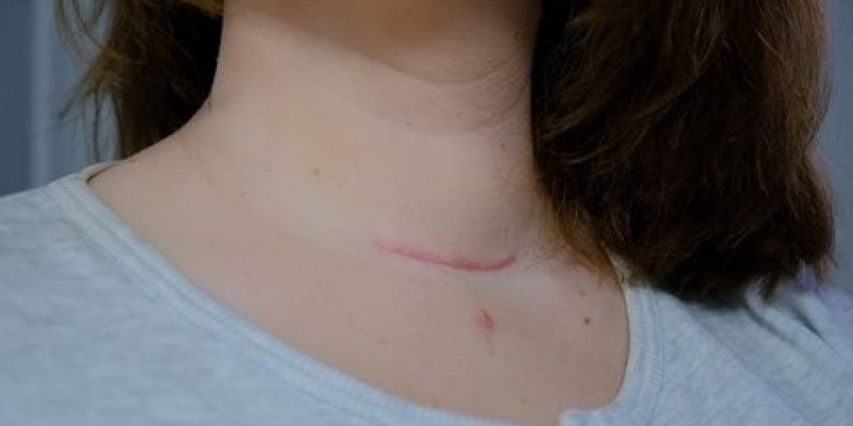 Factors Affecting Laser Scar Removal Costs
