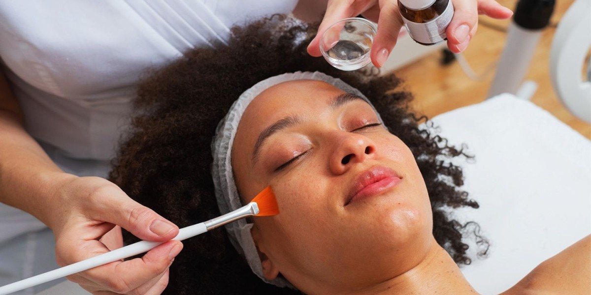 Is chemical peeling good for skin?