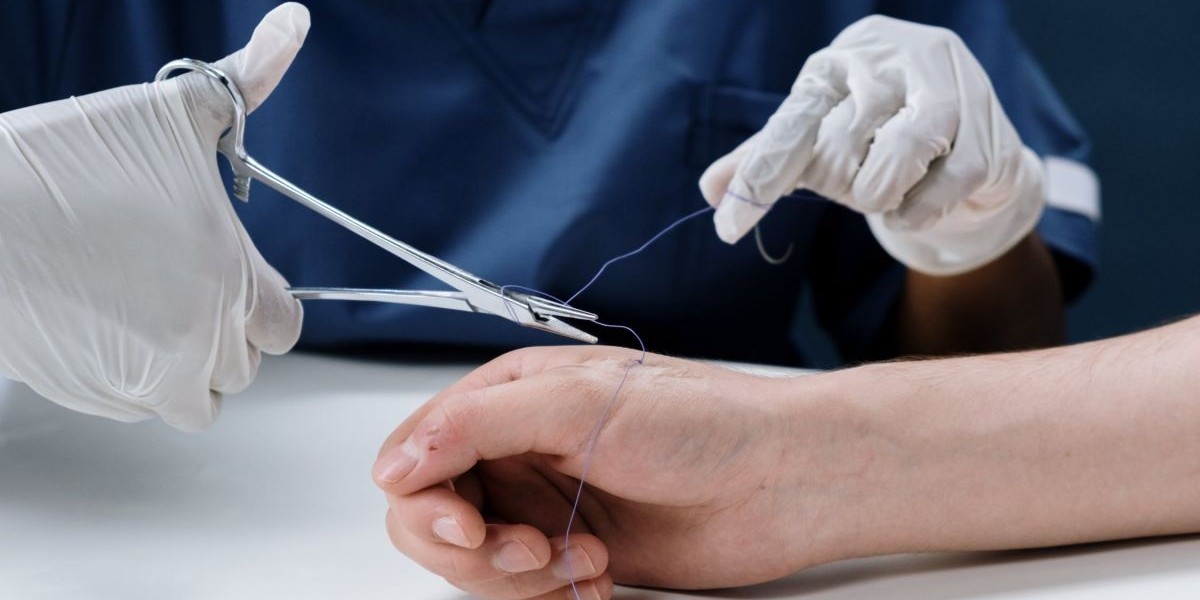 Can Urgent Care Do Stitches? A Guide to Common Injuries and Treatment Options