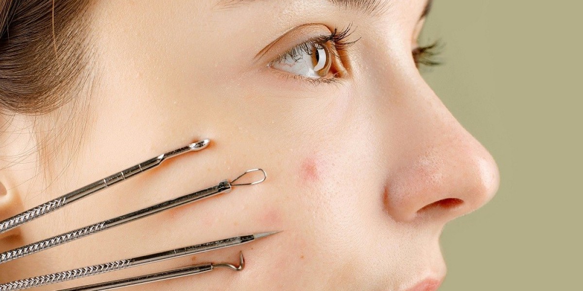 Why Microneedling is the Best Treatment for Acne Scars in Islamabad