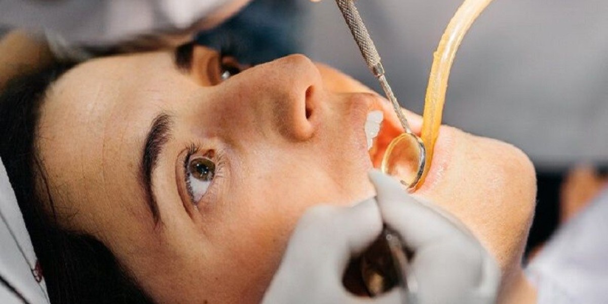 Root Canal Treatment: How Dubai Dentists Ensure Comfort and Care