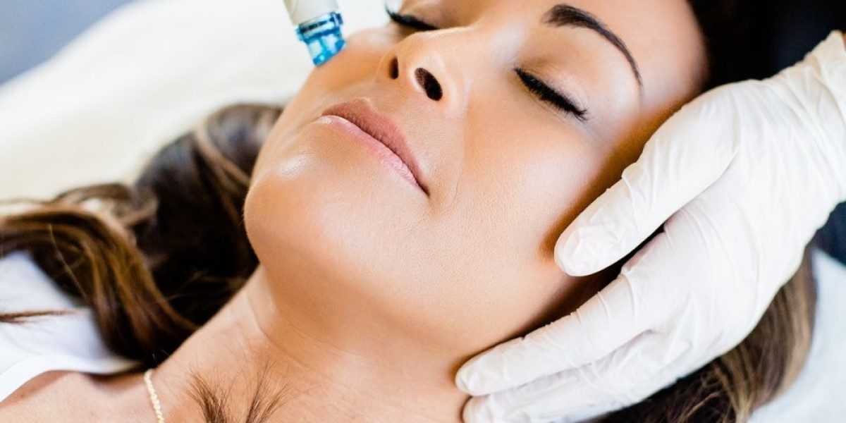 The Comprehensive Guide to Pico Laser Treatment and Its Benefits