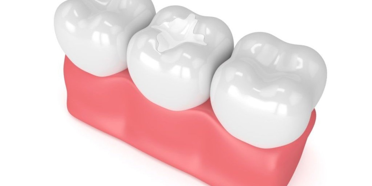 Tooth Filling Materials Market Outlook: Key Factors Driving Demand in Developed and Emerging Markets