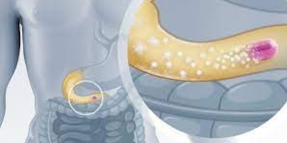 Colon Targeting Drug Delivery Market Report Highlighting Key Trends, Challenges, and Opportunities