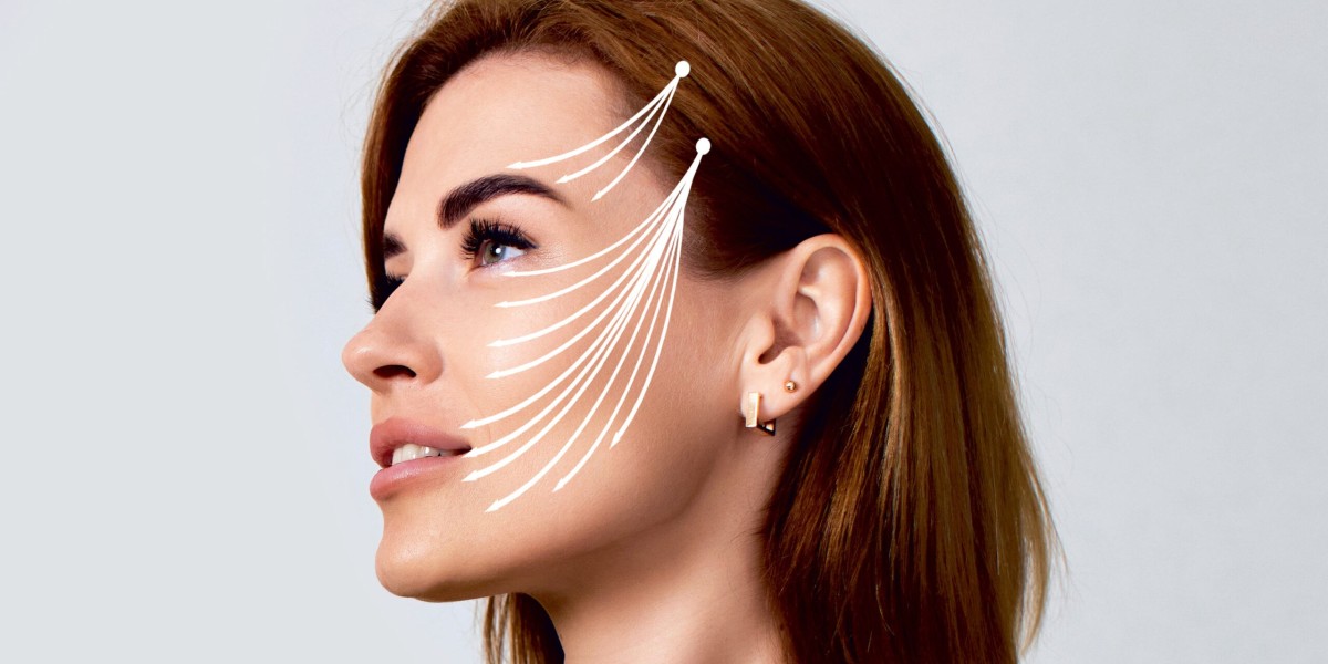 Thread Lift Treatment: What You Need to Know