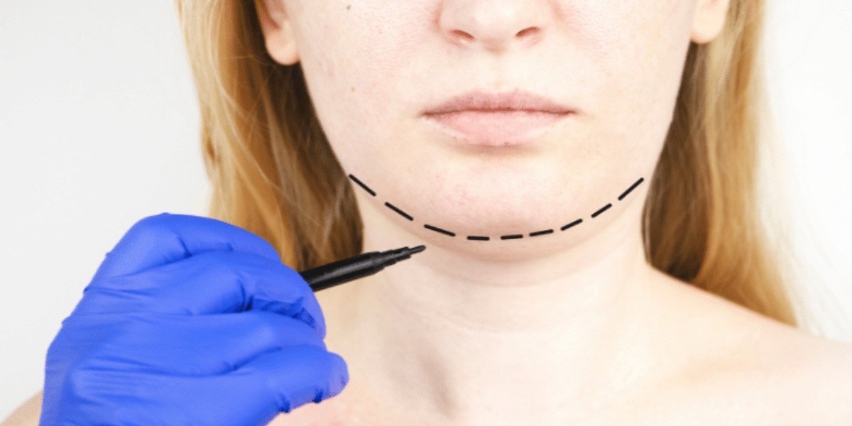 Tips for a Smooth Recovery from Double Chin Liposuction