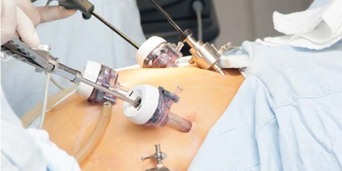 How Laparoscopic Surgery in Riyadh is Revolutionizing Riyadh Healthcare