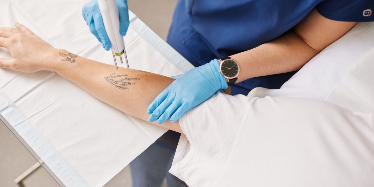 Remove Tattoos with Precision Using Laser Technology in Dubai