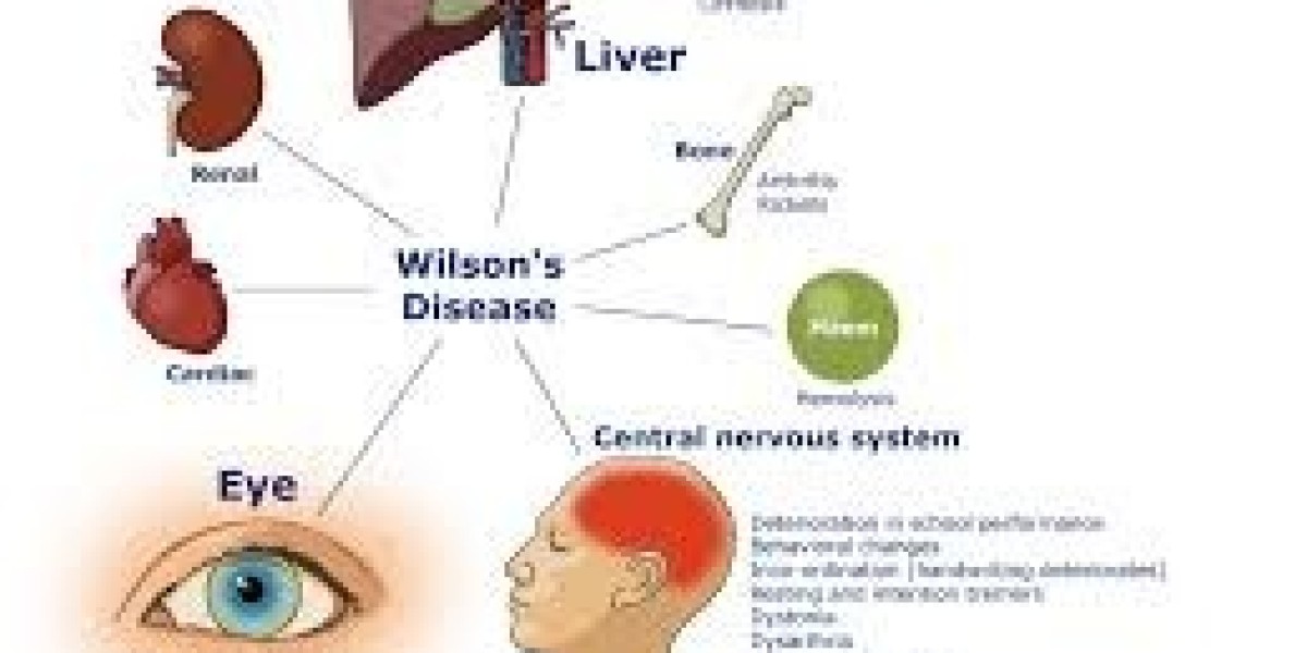 Wilson Disease Drug Pipeline Analysis Report 2024