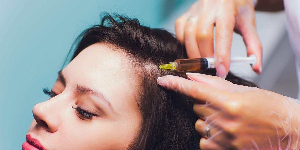 Top rated PRP hair therapy services in Riyadh