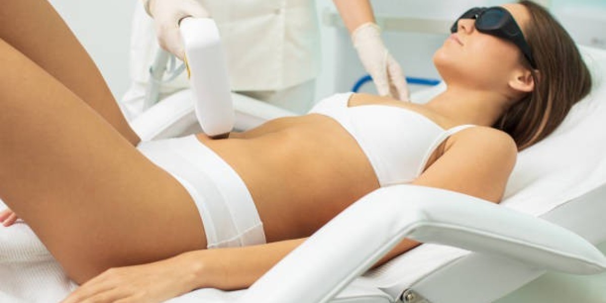 دليل شامل لإزالة الشعر بالليزر في الرياض