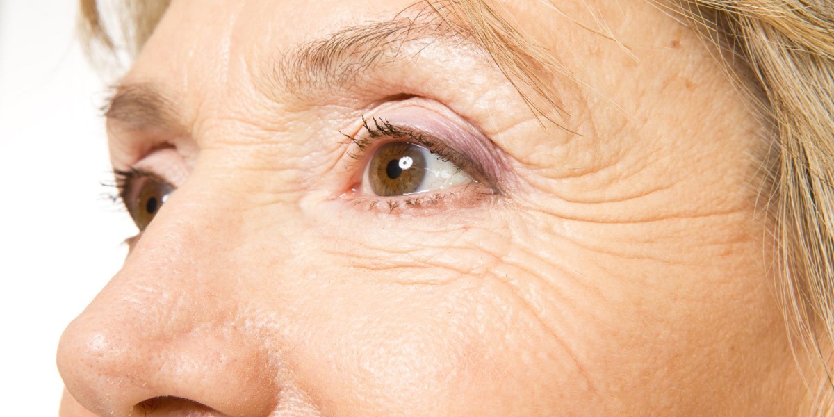 Effective Anti-Wrinkle Treatments You Can Trust in Riyadh