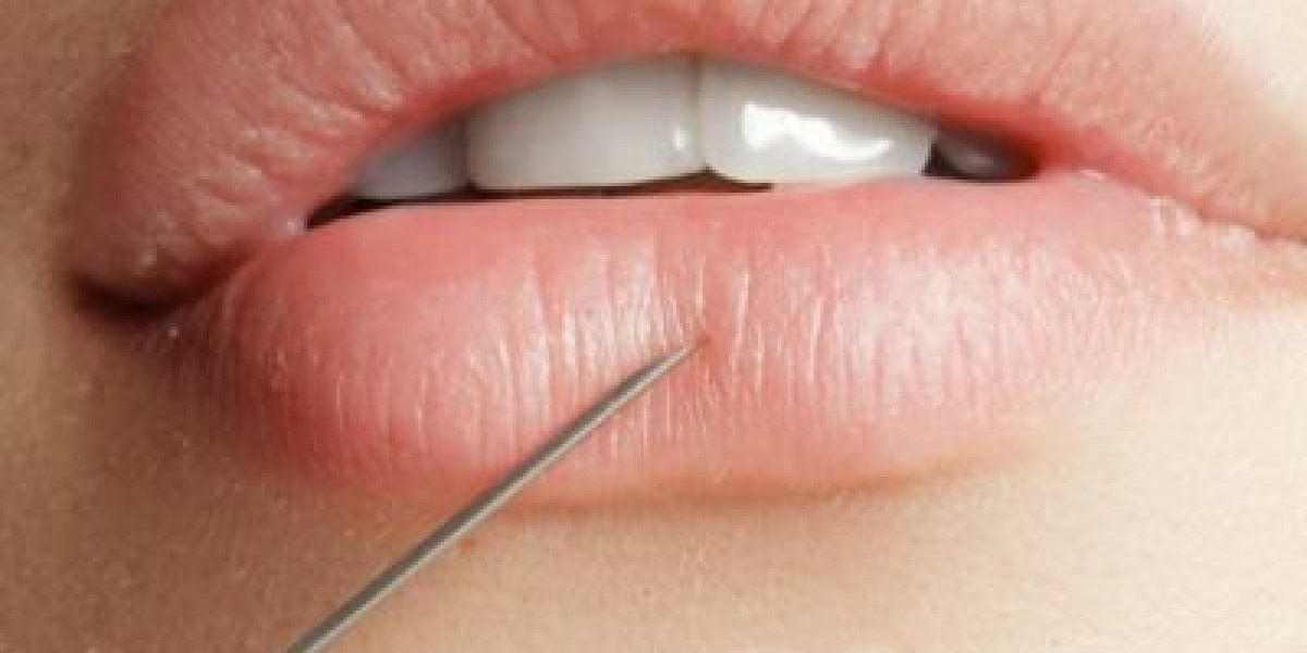 Discover the Affordable Beauty of Mesotherapy in Dubai