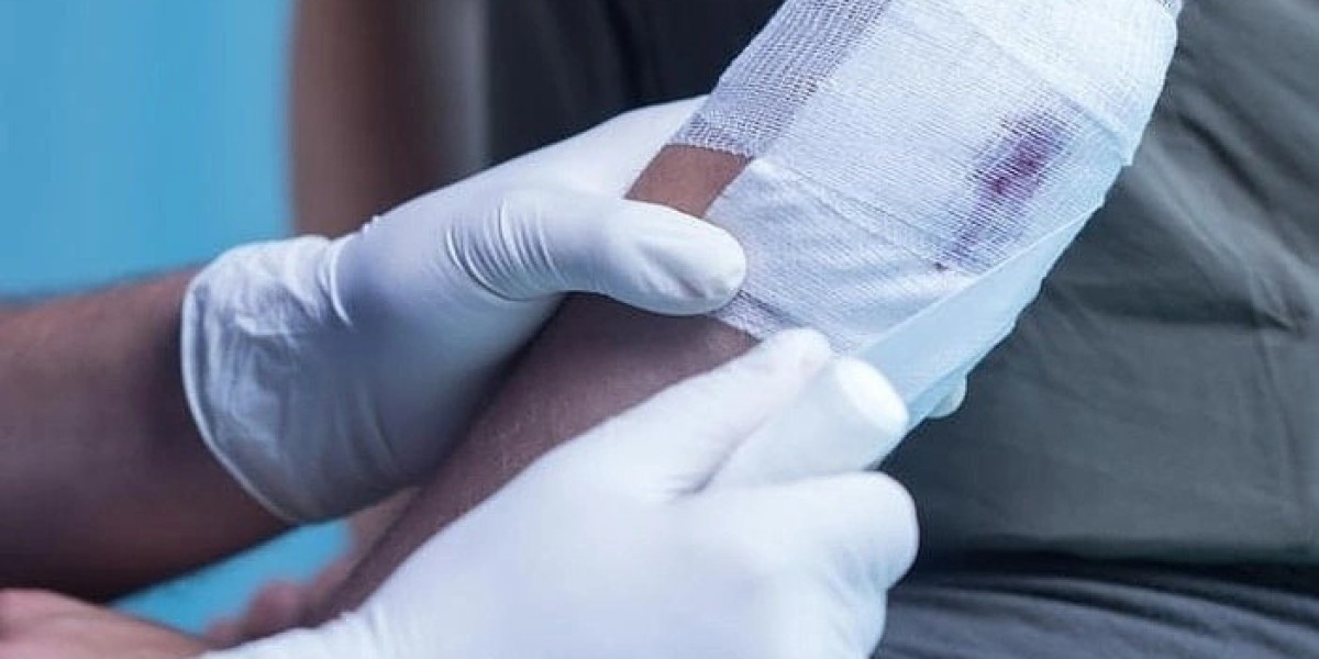 Antimicrobial Dressing Market Dynamics: Acquisition Strategies Driving Growth