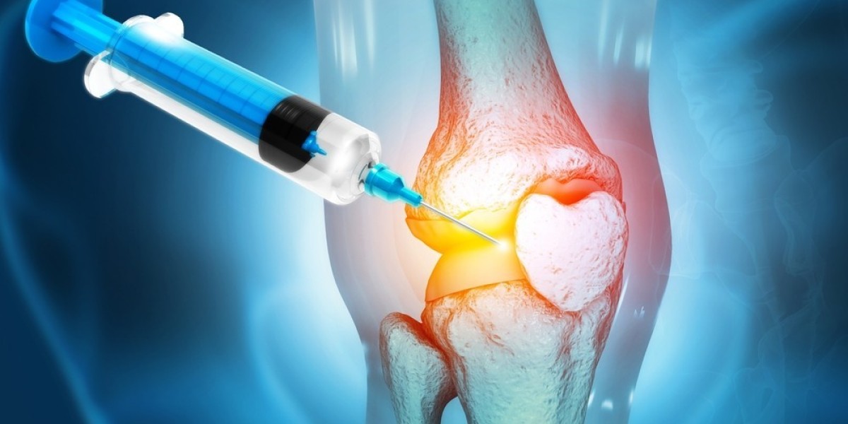 Viscosupplementation Market Innovations and Technological Advancements: How New Developments Are Shaping the Industry’s 