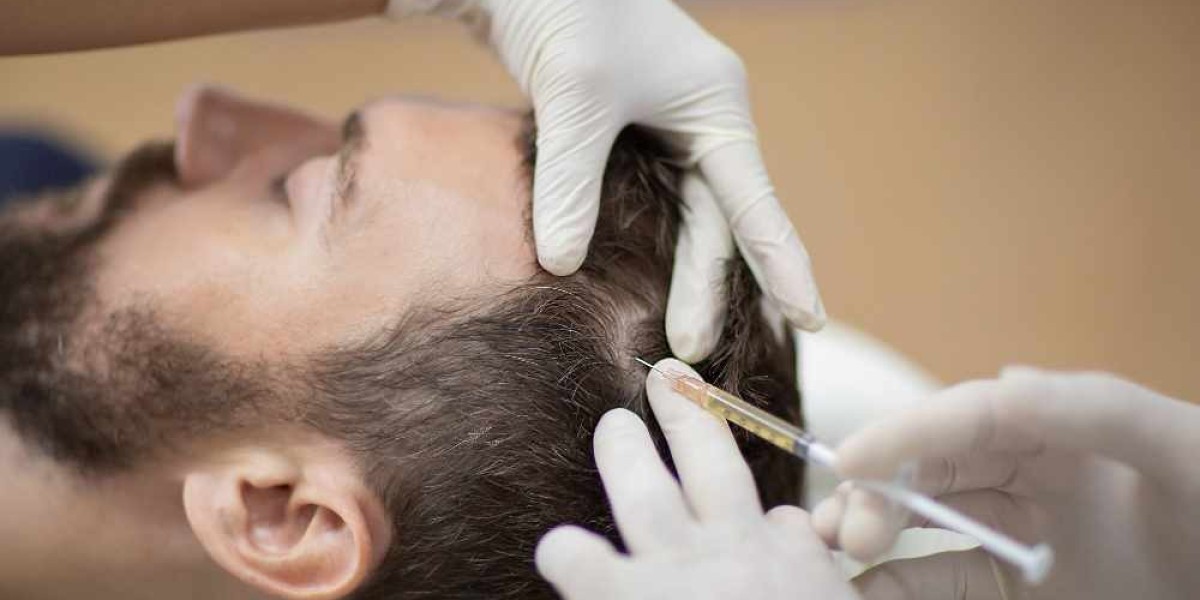 Revitalize Your Hair with PRP Hair Treatment in Mississauga