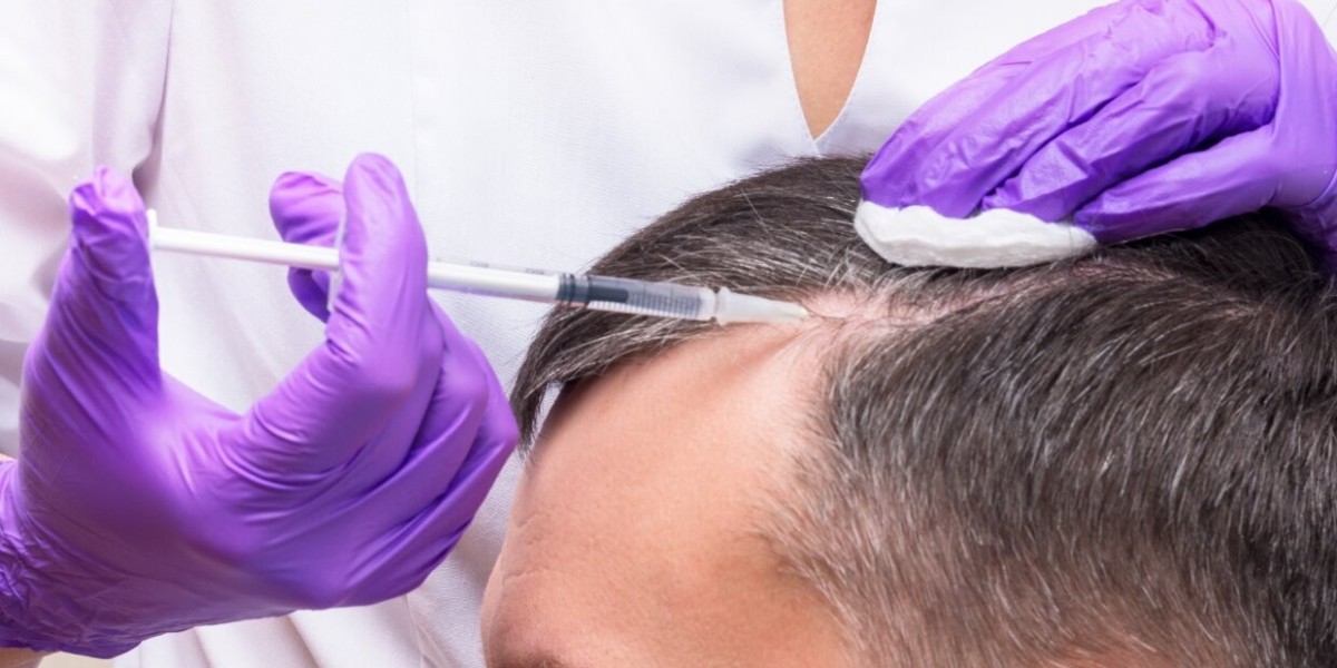 PRP Hair Treatment benefits