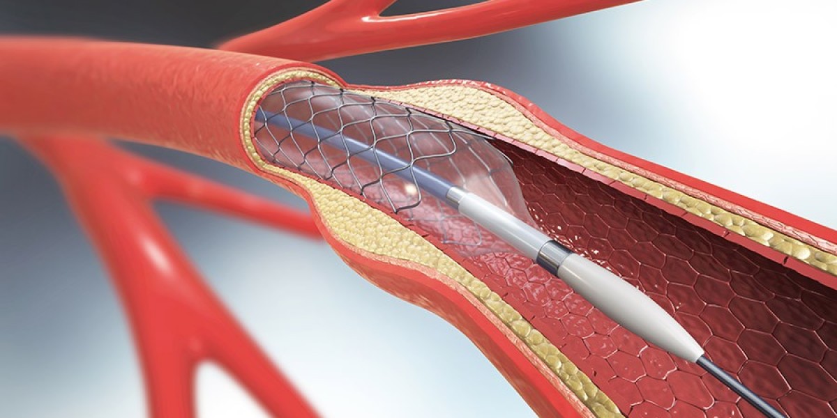 Angioplasty Balloons Market Competitive Landscape, Innovations, and Market Share Insights