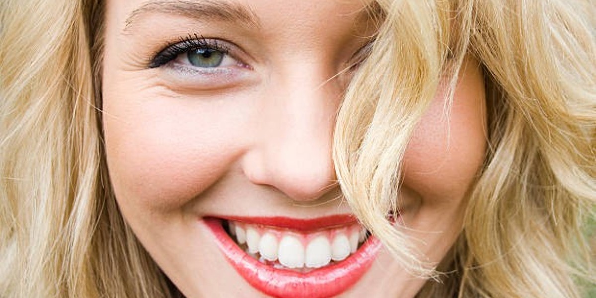 Exploring Hollywood Smile Price Options in Riyadh