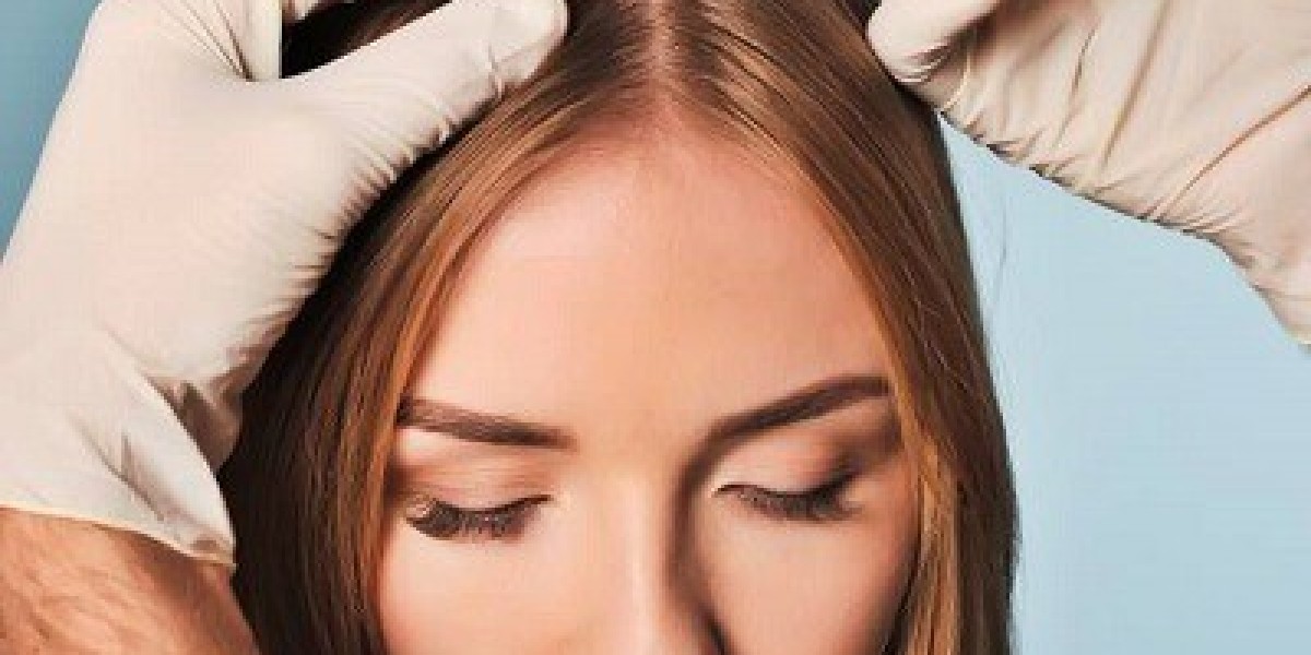 Top PRP Options at a Lower Price: Achieving Healthy Skin and Hair Without Breaking the Bank