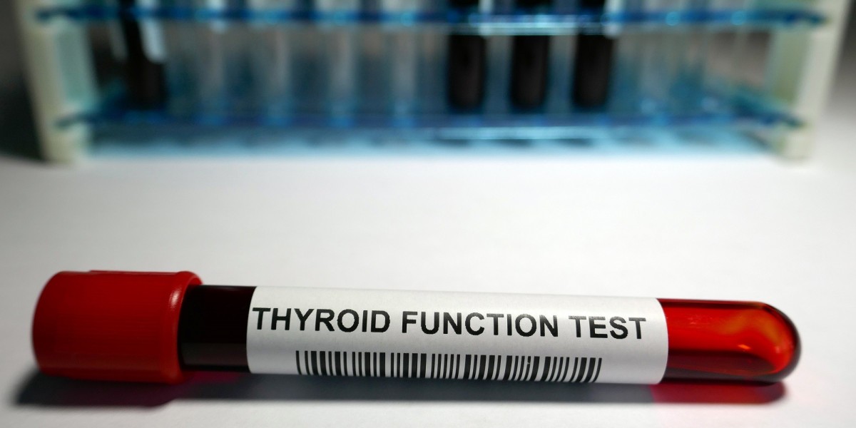 Thyroid Function Test Market Developments: Tracking the Latest Technological Advancements, Product Launches, and Market 