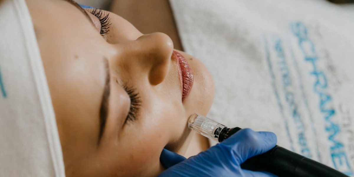 When Is the Best Time to Get Pico Laser Treatment for Scarring?