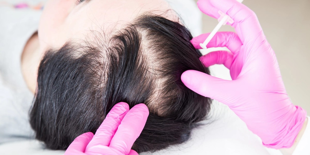How long does a hair transplant take in Dubai?