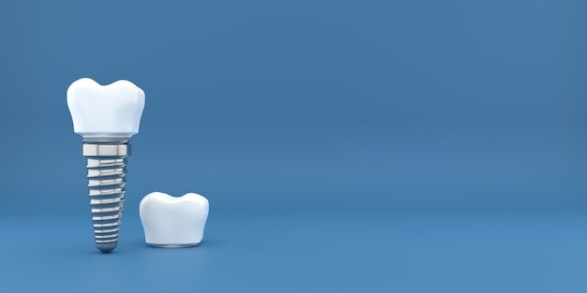 Implant-Supported Bridges: Bridging the Gap with Confidence