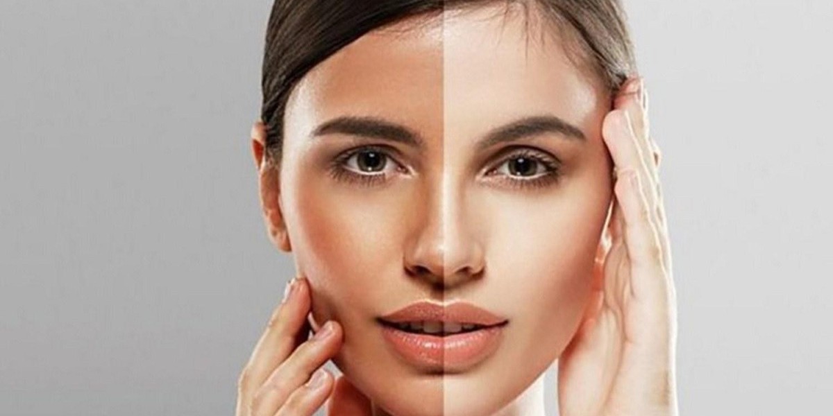 Top 5 Skin Whitening Clinics in Riyadh for Expats