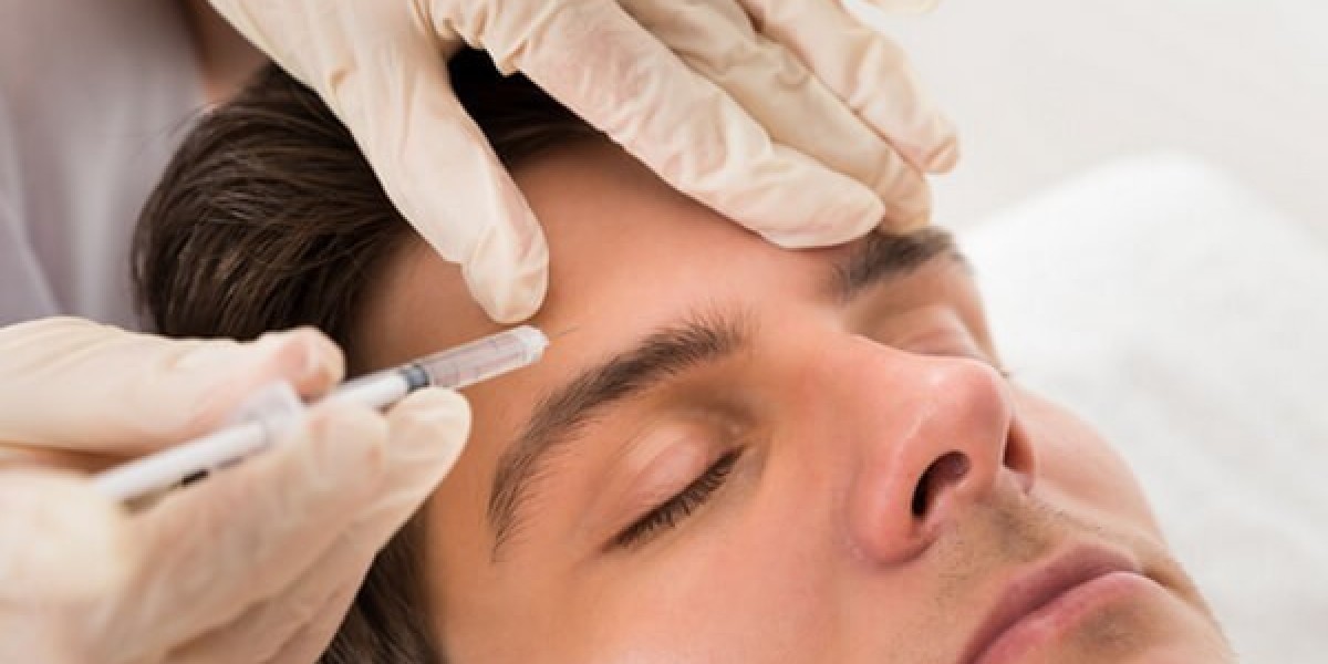 What 3 areas are best for Botox?