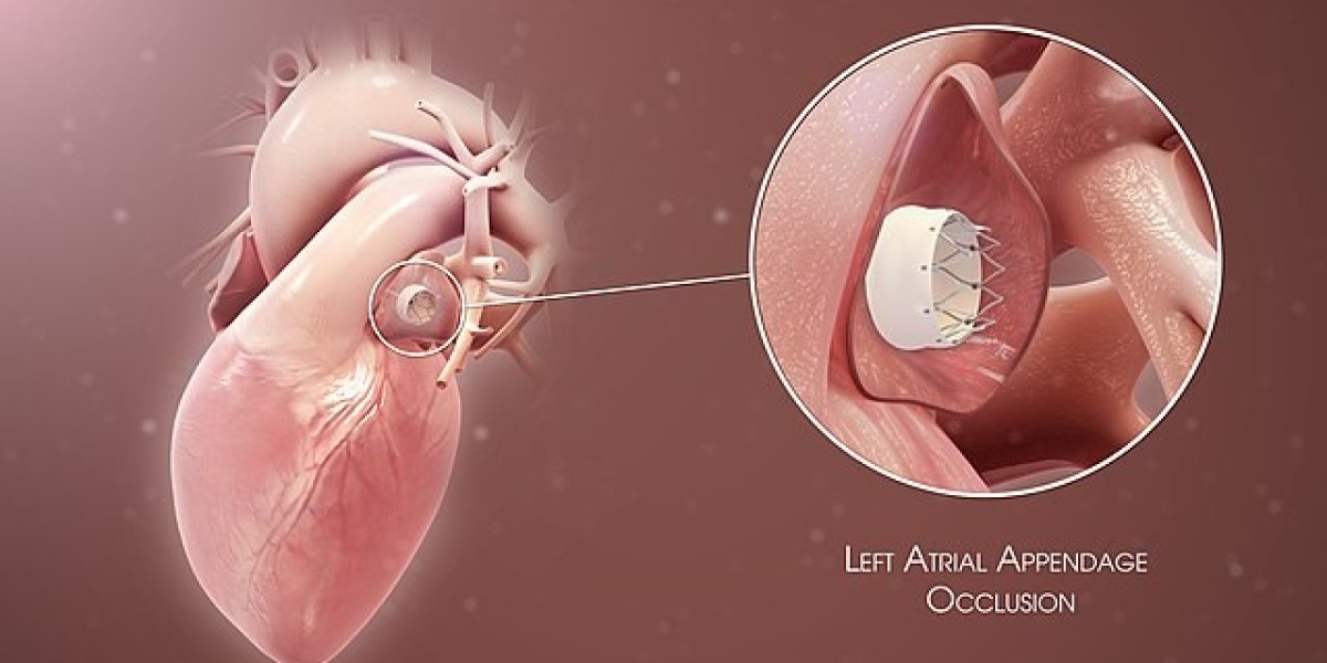 Atrial Fibrillation Devices Market: How Minimally Invasive Treatments Are Accelerating Demand
