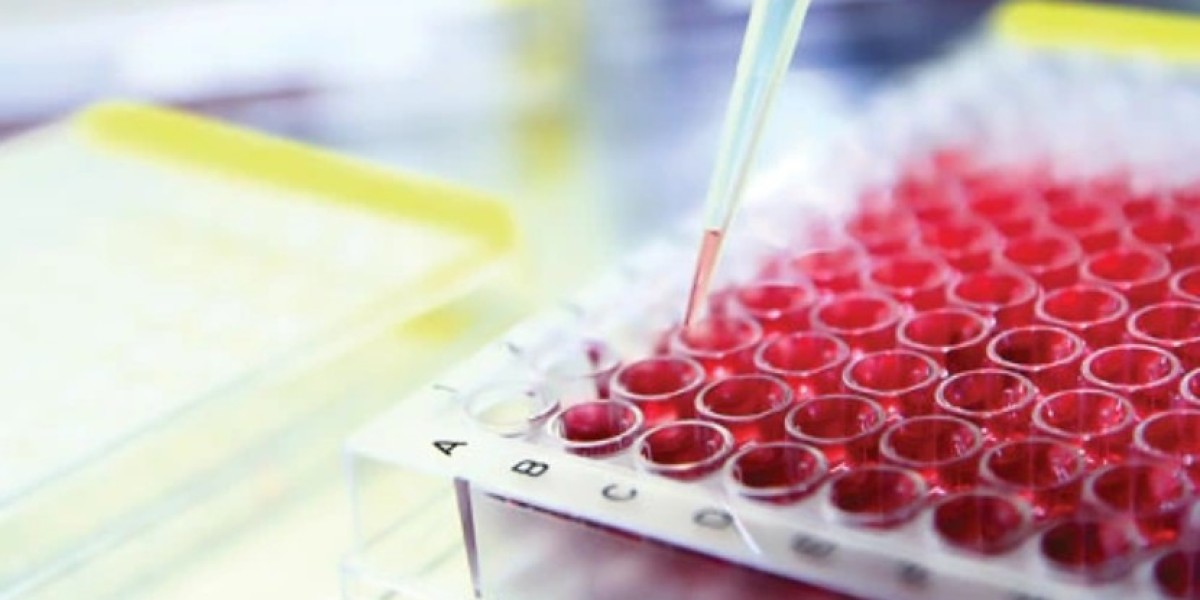 Global Cell-based Assays Market Share, Size, Trends, Outlook, Growth & Forecast | 2024 - 2032
