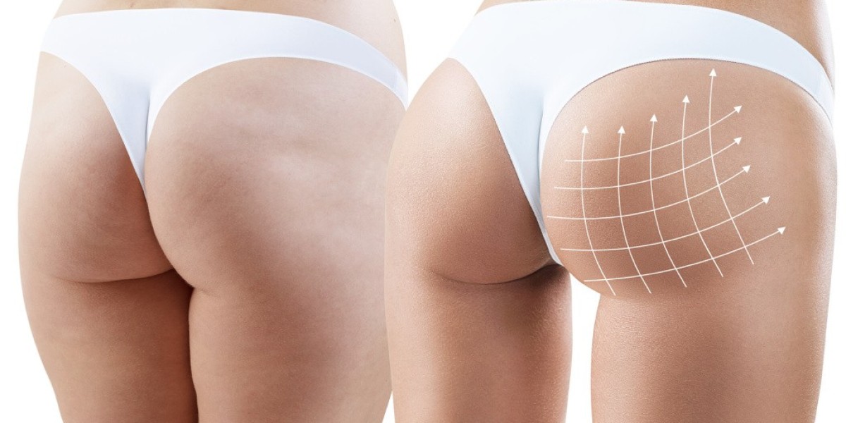 Top-rated plastic surgeons for Brazilian butt lift in Riyadh