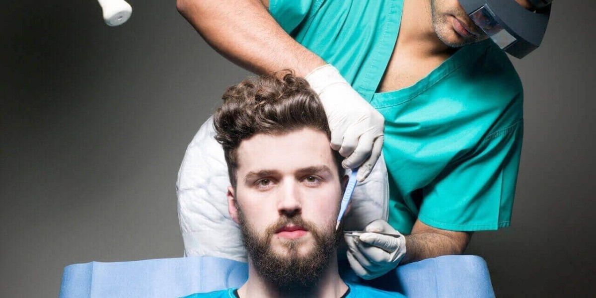 Permanent Beard Solutions in Riyadh: Hair Transplants Explained