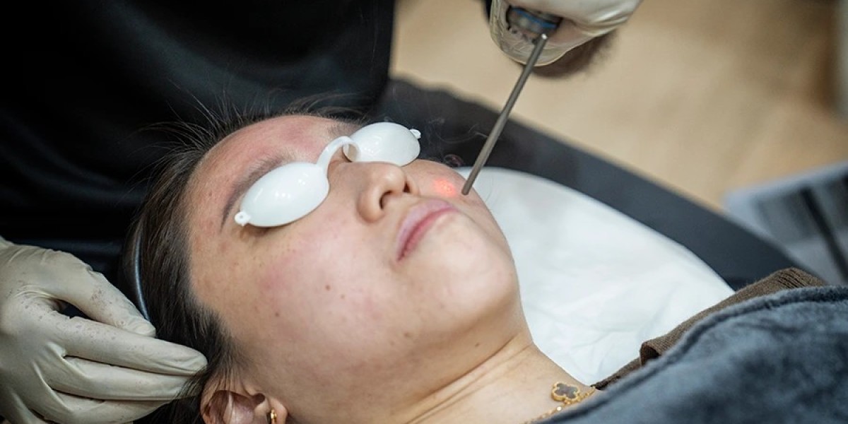 Pico Laser Treatment in Dubai: The Advanced Solution for Skin Rejuvenation