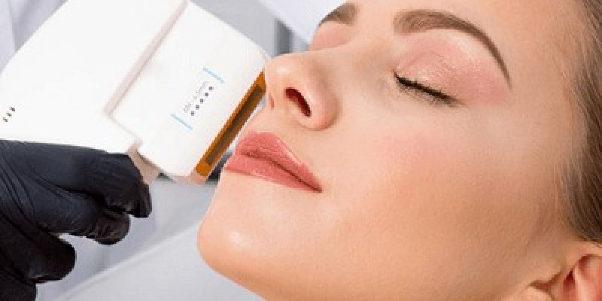 HIFU: Can It Really Tighten Skin? What You Need to Know