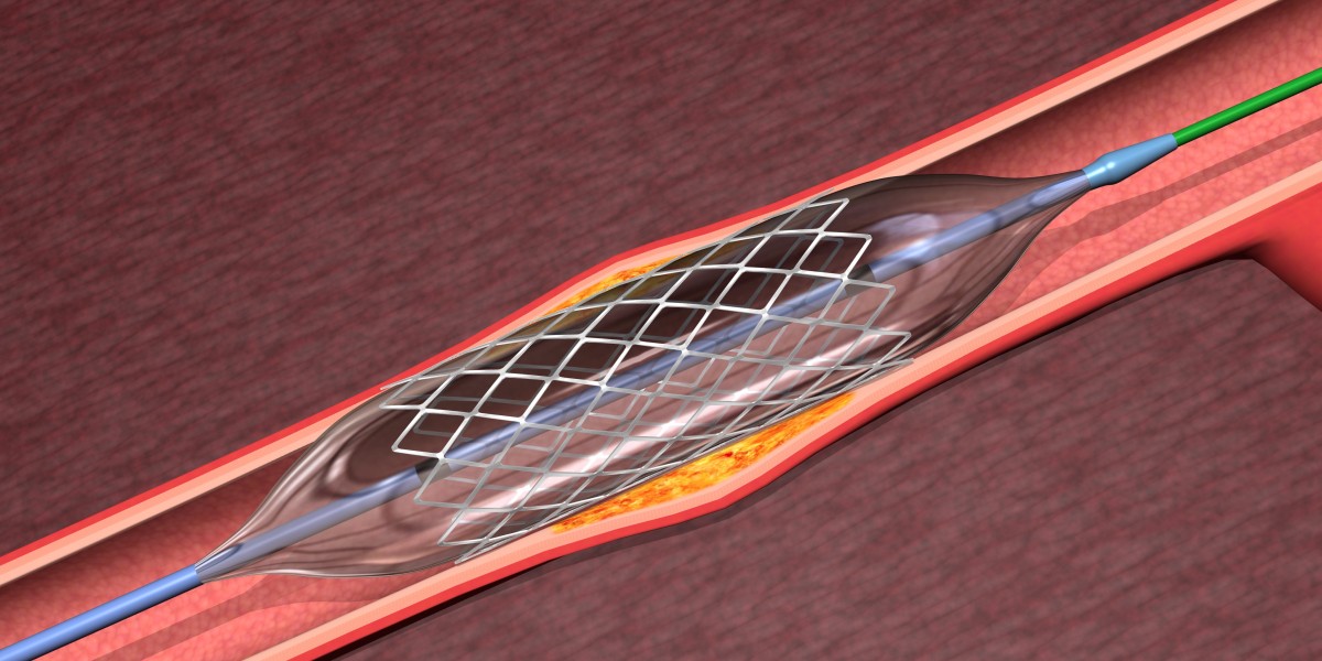 Angioplasty Balloons Market Research: Understanding Consumer Preferences and Buying Behavior in the Healthcare Space