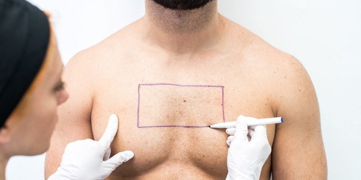 Is chest hair good for hair transplant?