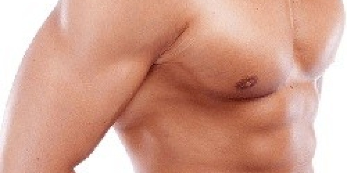 Gynecomastia Surgery: A Solution for Men