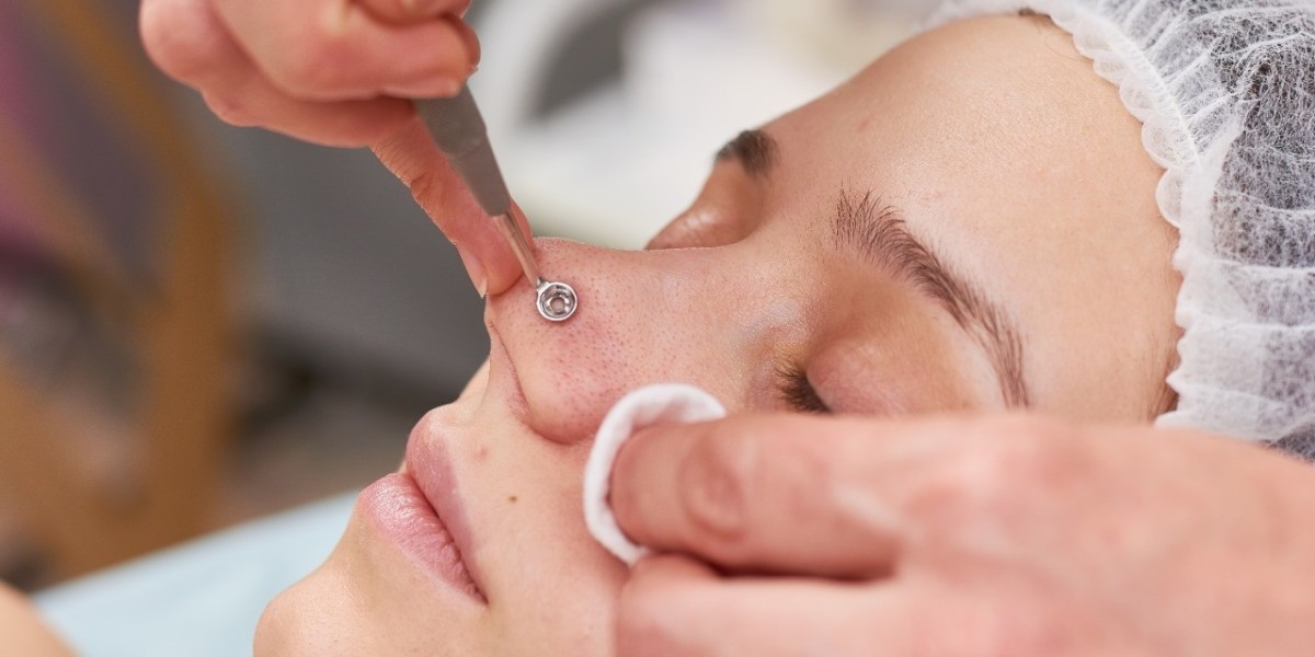 Deep Cleansing Facials The Key to Radiant Skin in Dubai