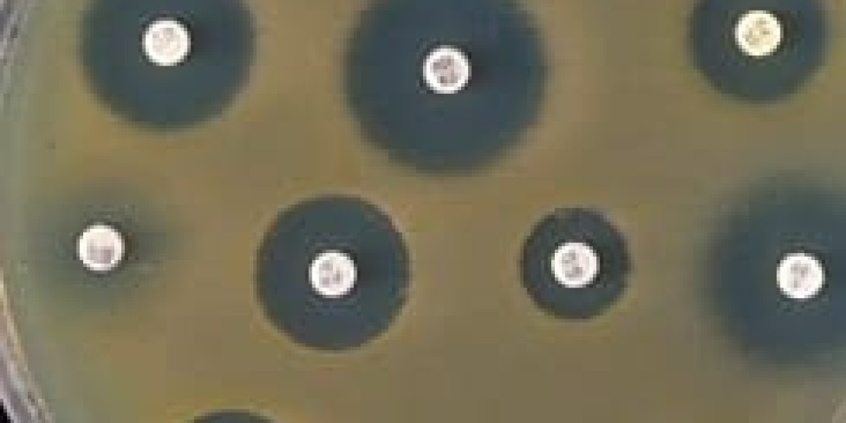 Antimicrobial Susceptibility Test Market: Exploring the Role of Point-of-Care Testing and Its Influence on Market Growth