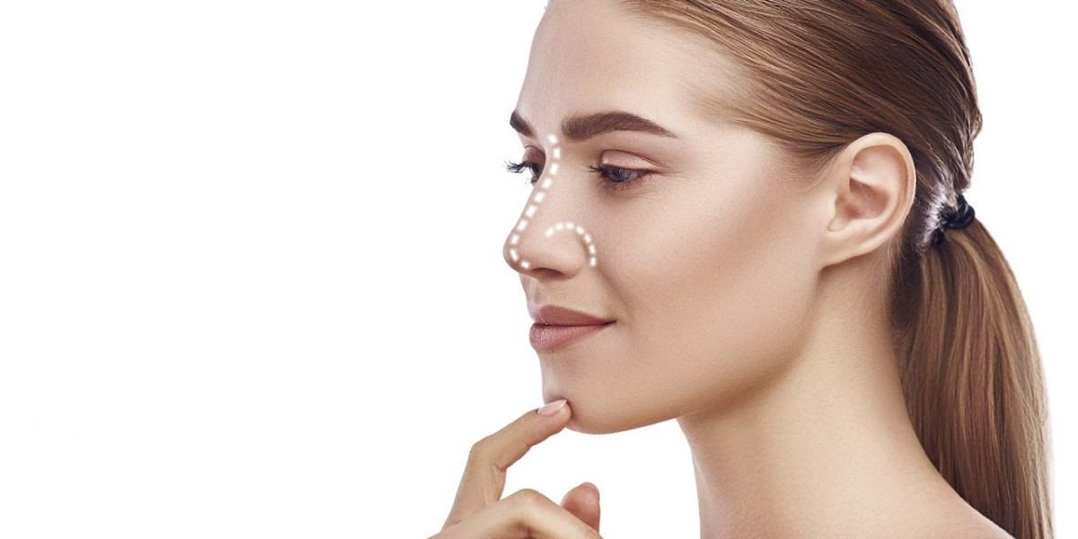 Recovery Time After Rhinoplasty Surgery in Riyadh