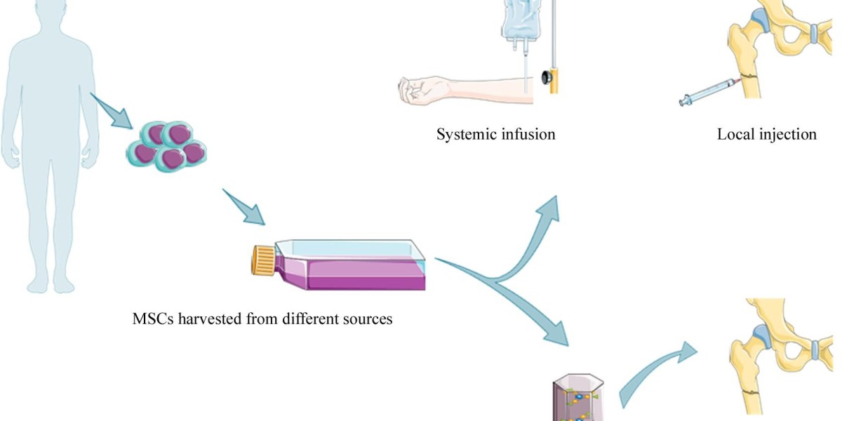 Bone Regeneration Market: Exploring Opportunities for Innovation and Growth